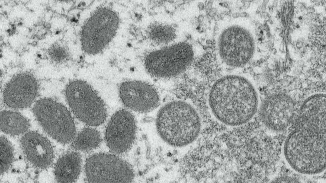 Monkeypox now a global health emergency, says W.H.O. - Vimarsana News