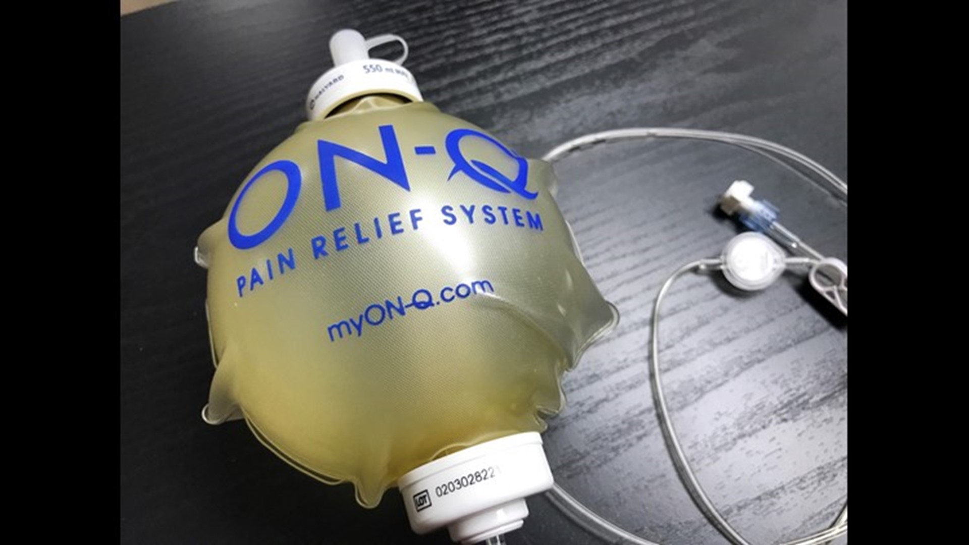 A painfree Csection How can major surgery require no prescription pain killers?