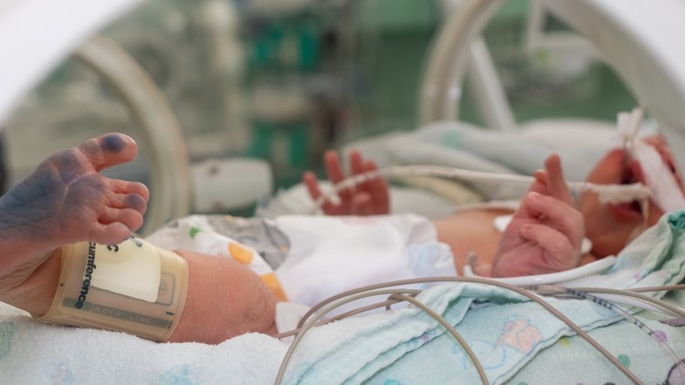 Texas receives a 'D' grade for its number of preterm births